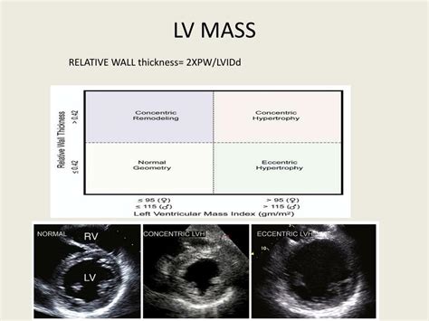 lv mass echo|left ventricular mass index chart.